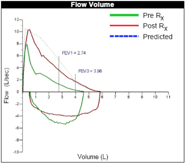 Flow Volume Graph