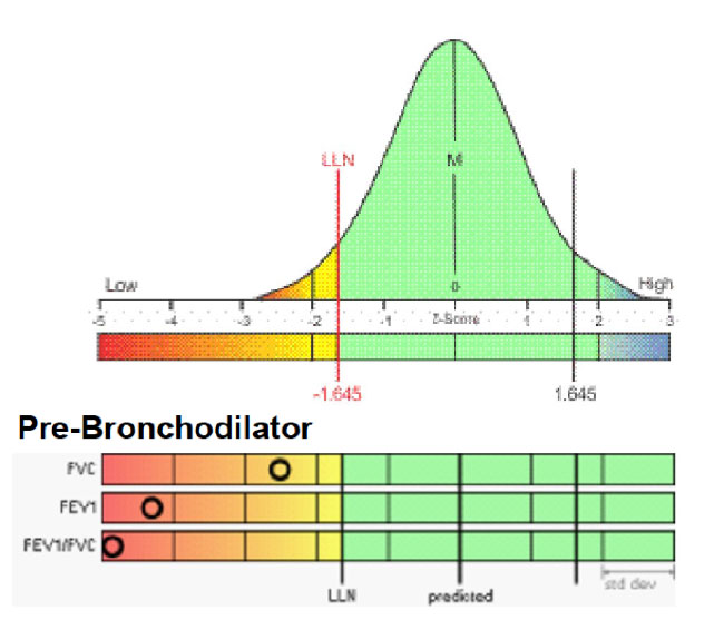What Is Z Score In Pulmonary Function Test Ideas of Europedias