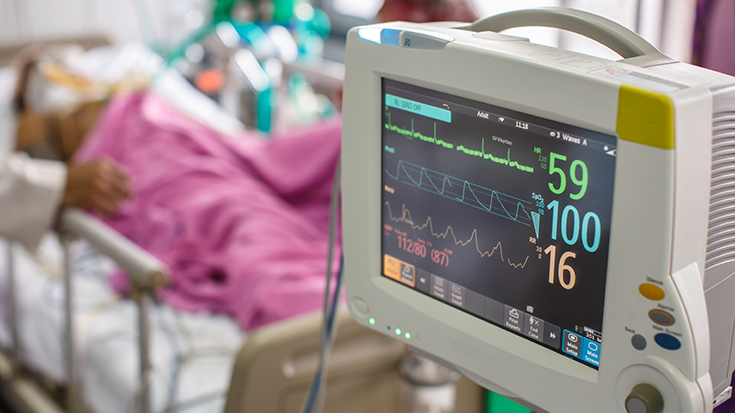 Monitoring During Mechanical Ventilation