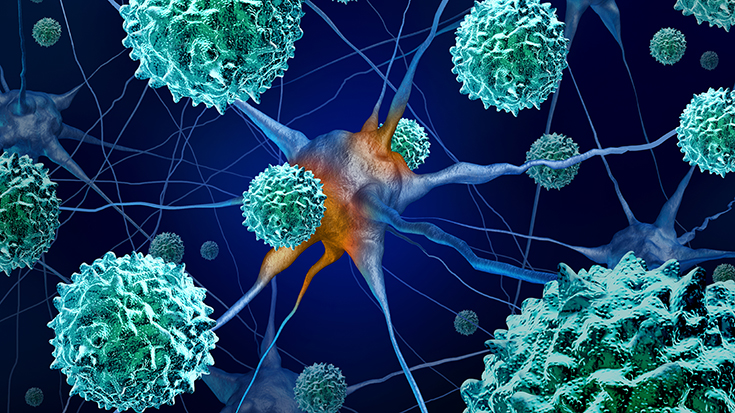 image of AFM disease