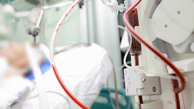 ecmo machine