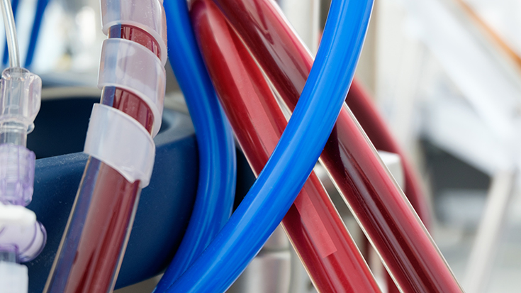 closeup image of ECMO machine tubes