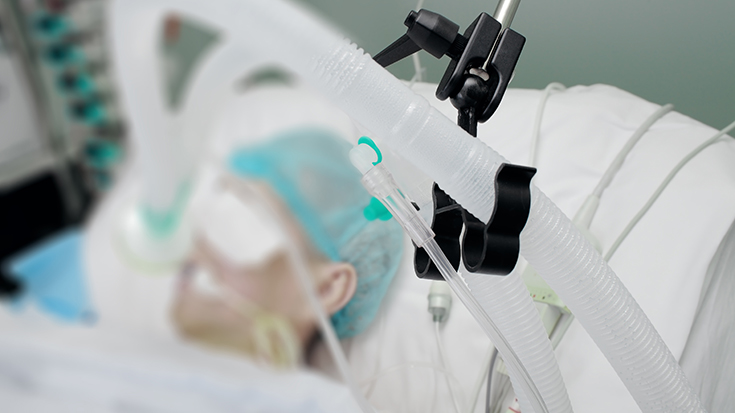 image of patient on mechanical ventilator