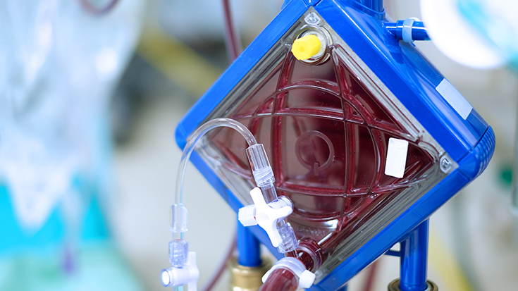 ecmo machine close up shot