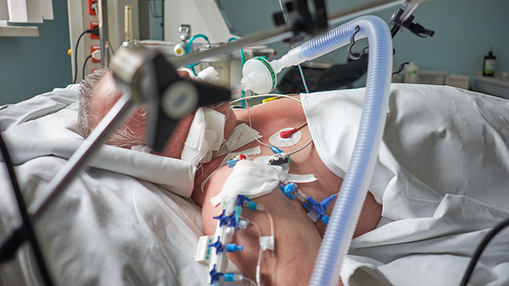 image of man on ventilator